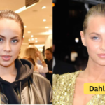 Kasia Lenhardt Todesursache